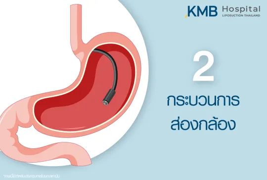 ส่องกล้อง