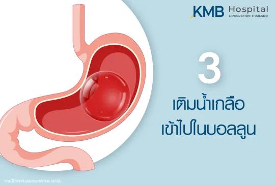 เติมน้ำเกลือ