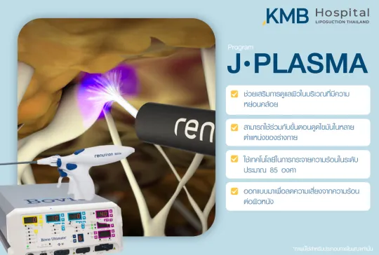 J-Plasma