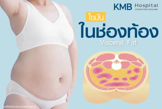 ไขมันในช่องท้อง