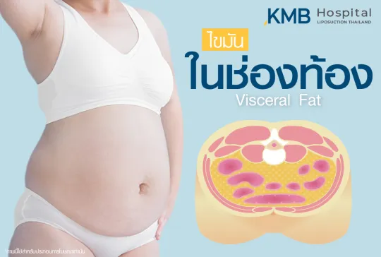 ไขมันในช่องท้อง