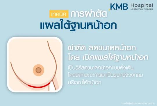 เทคนิคการผ่าตัดแผลใต้ฐานหน้าอก