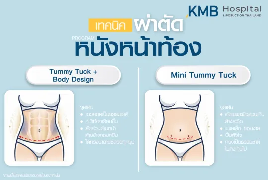 เทคนิคผ่าตัดหนังหน้าท้อง