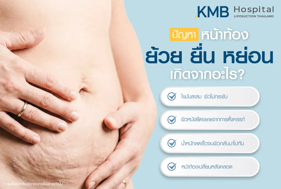 ปัญหาหน้าท้อง ย้วย ยื่น หย่อน เกิดจากอะไร