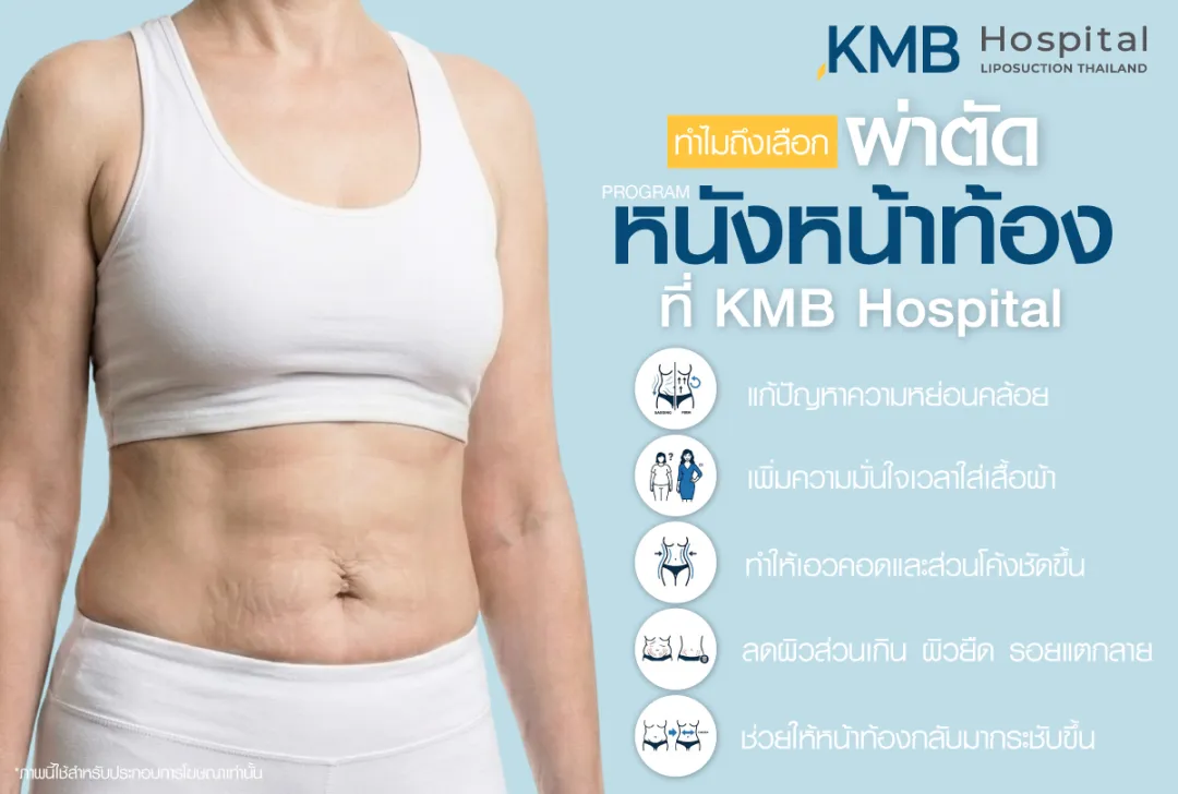 ทำไมถึงเลือกผ่าตัดหนังหน้าท้องที่ KMB Hospital