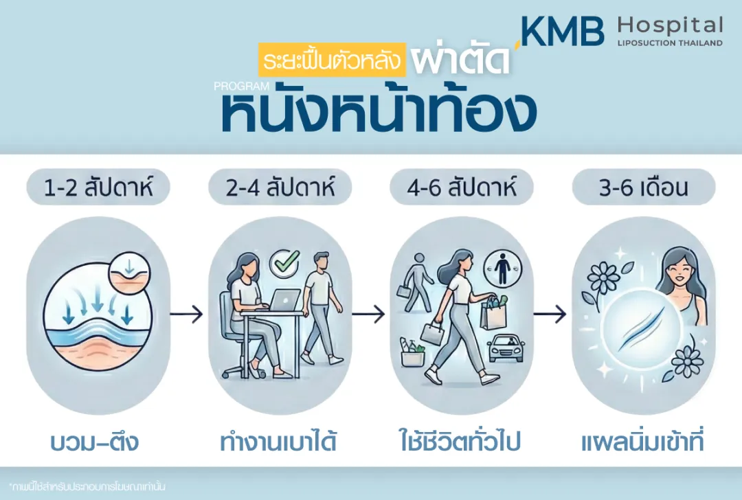 ระยะฟื้นตัวหลังผ่าตัดหนังหน้าท้อง