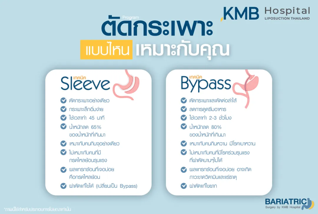 ตัดกระเพาะแบบไหนเหมาะกับคุณ