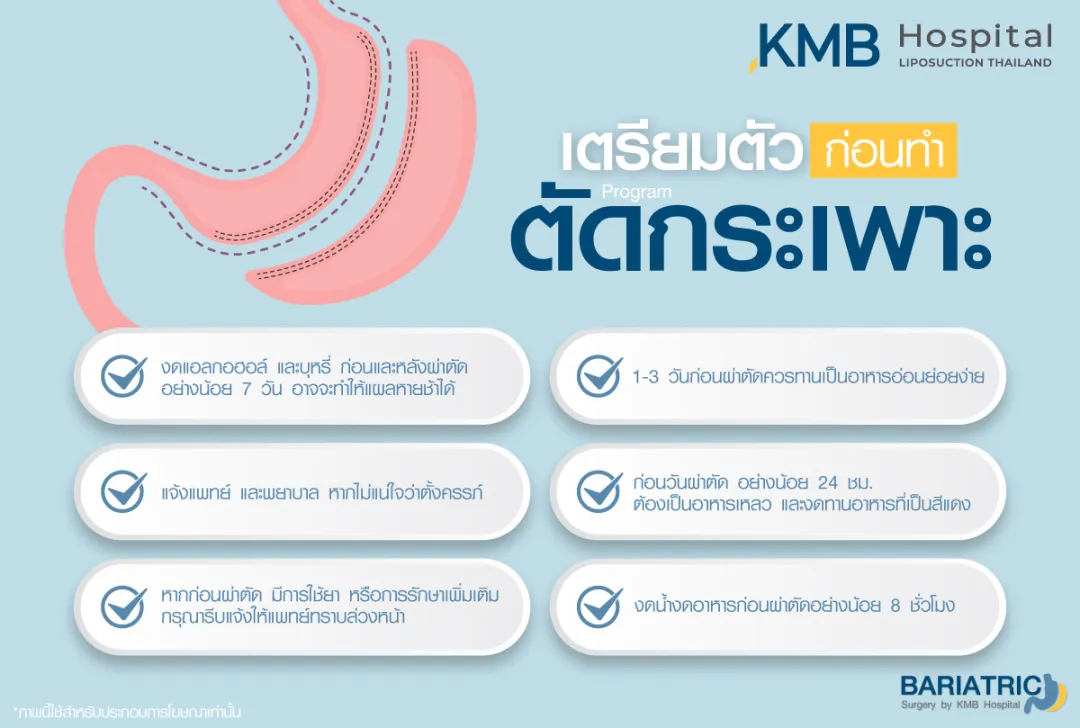 การเตรียมตัวก่อนตัดกระเพาะ