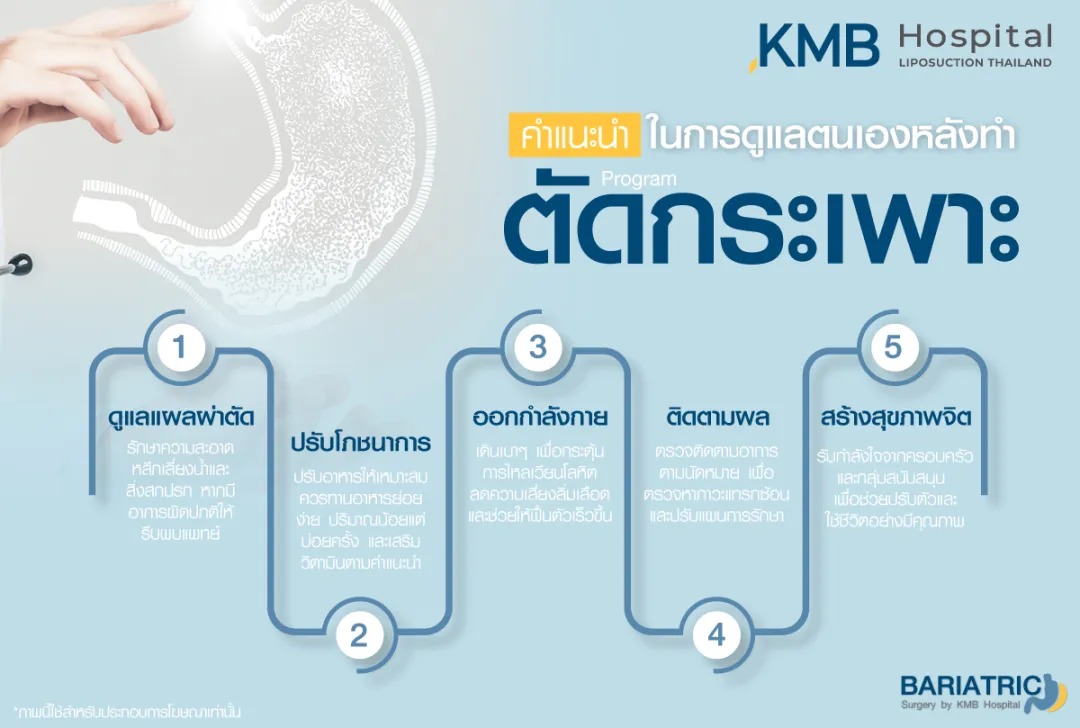 คำแนะนำในการดูแลหลังตัดกระเพาะ