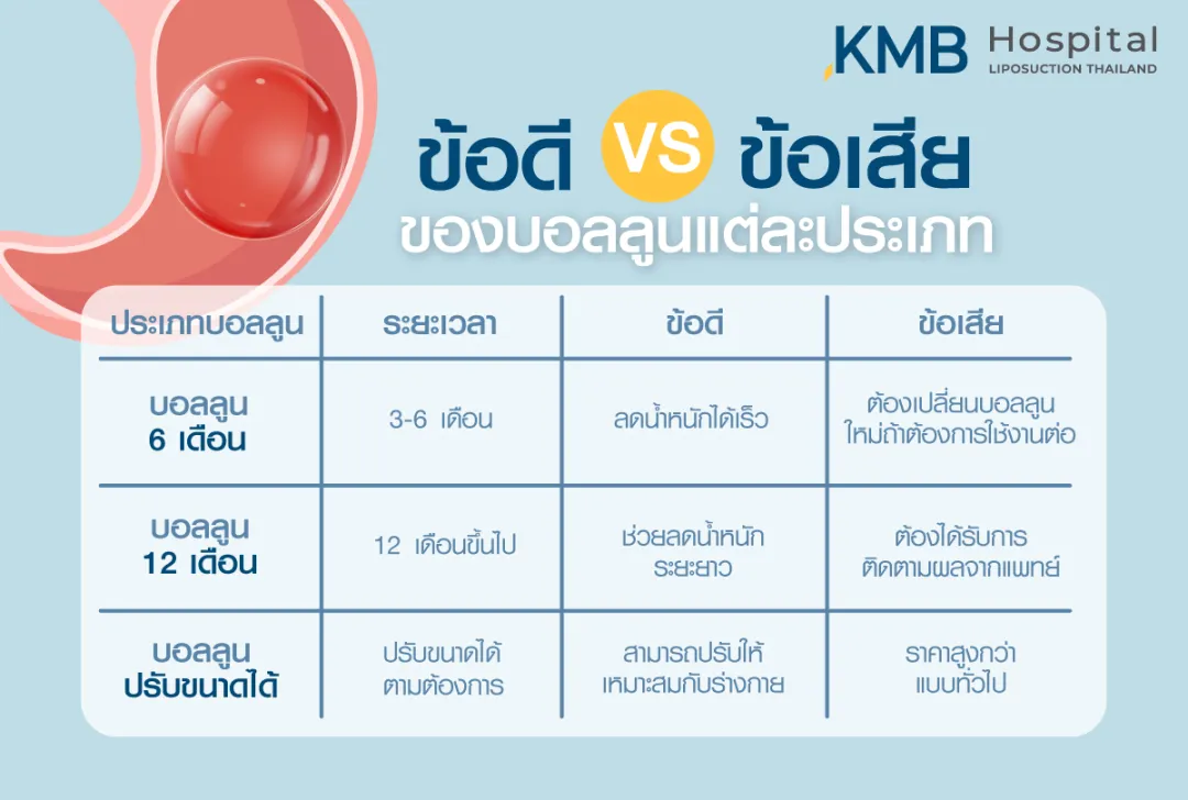 ข้อดี ข้อเสีย ของบอลลูนแต่ละประเภท