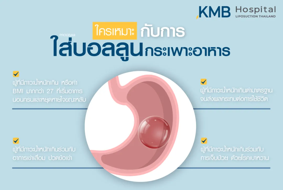 ใครเหมาะกับการใส่บอลลูนกระเพาะอาหาร