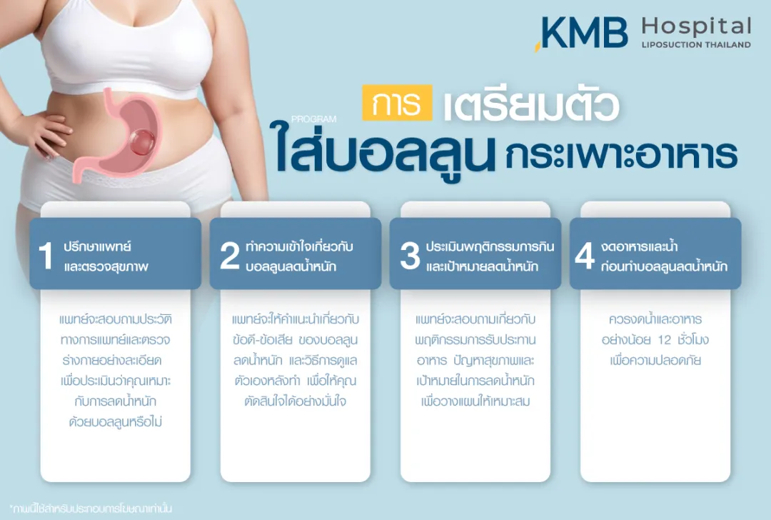 การเตรียมตัวสำหรับใส่บอลลูนกระเพาะอาหาร