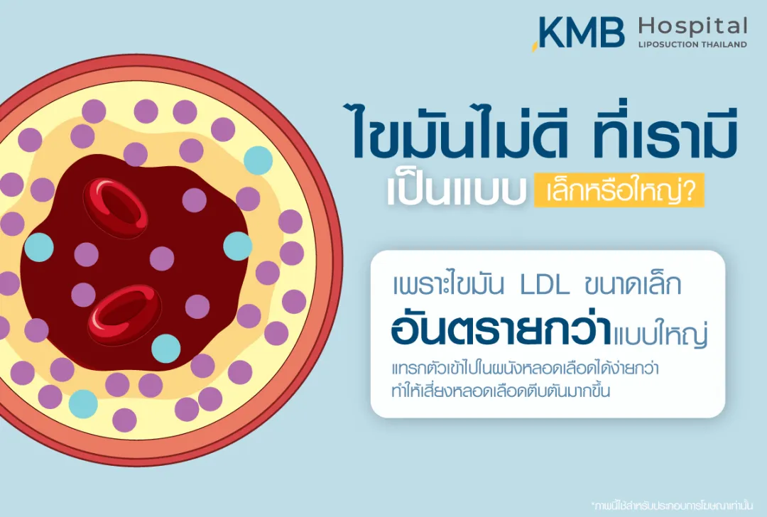 ไขมันไม่ดี ที่เรามี