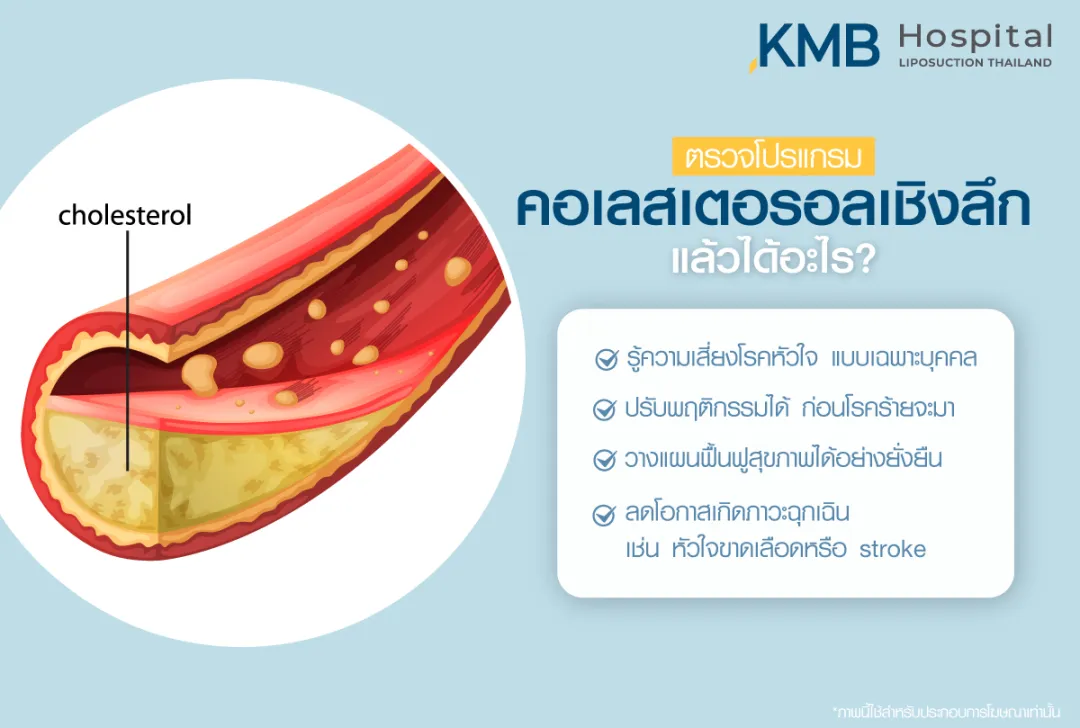 ตรวจคอเลสเตอรอลเชิงลึก แล้วได้อะไร