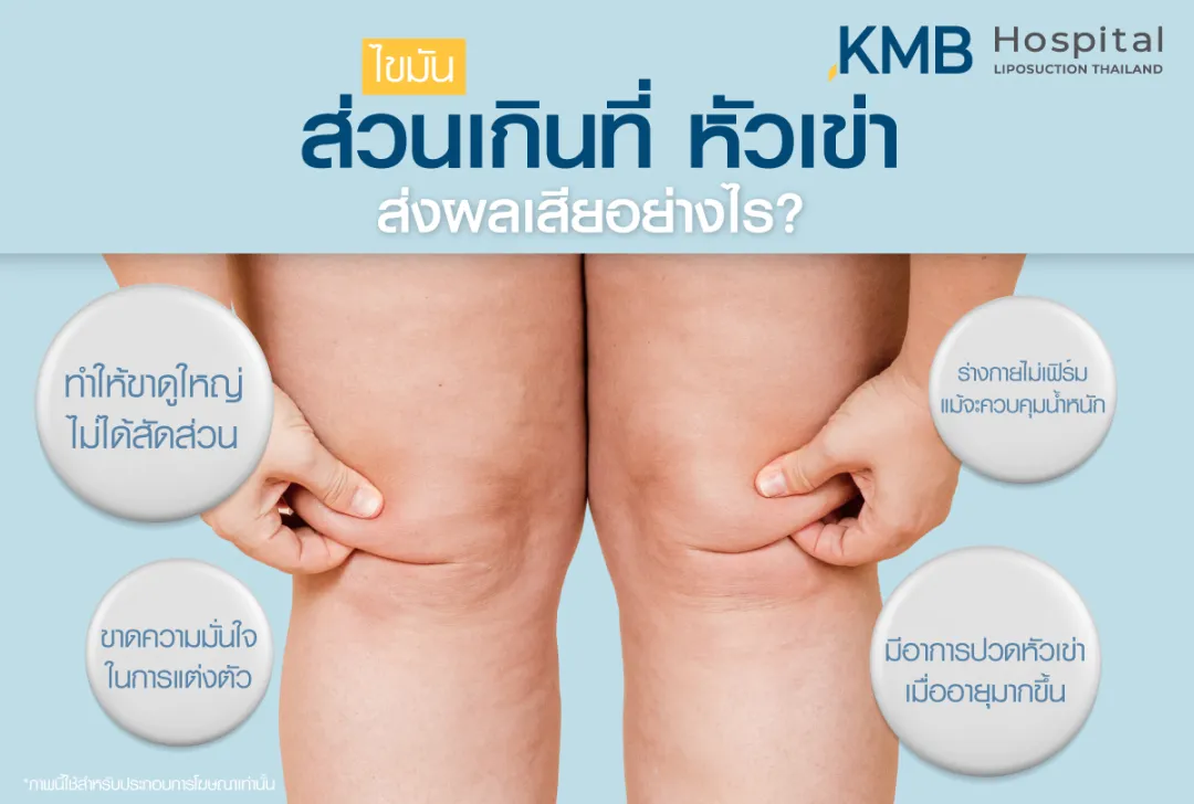 ส่วนเกินที่หัวเข่า ส่งผลเสียอย่างไร