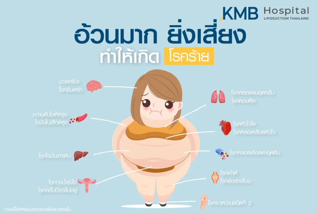 อ้วนมากยิ่งเสี่ยง