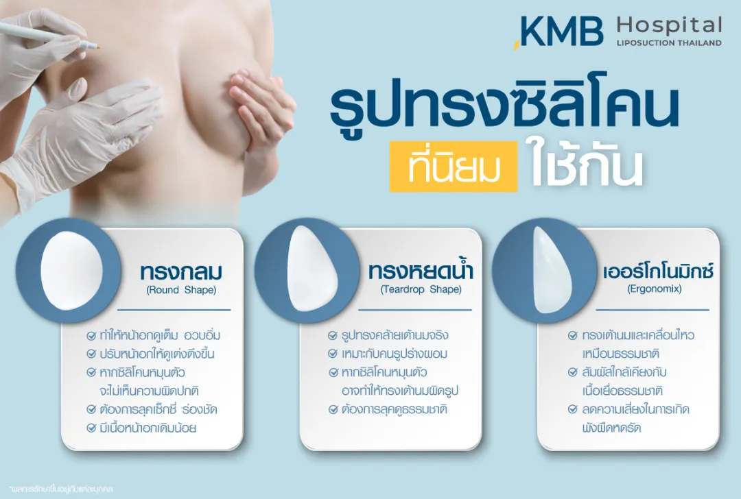 รูปทรงซิลิโคนที่นิยมใช้เสริมหน้าอก