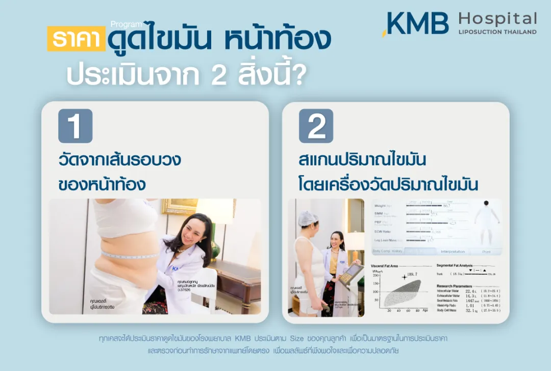 การประเมินค่าใช้จ่ายเบื้องต้นในการดูดไขมันหน้าท้อง