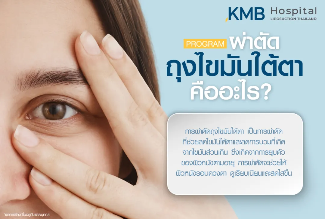 ผ่าตัดถุงไขมันใต้ตาคืออะไร