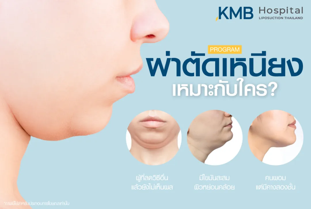 ผ่าตัดเหนียงเหมาะกับใคร