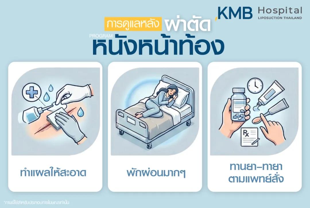 การดูแลหลังผ่าตัดหนังหน้าท้อง