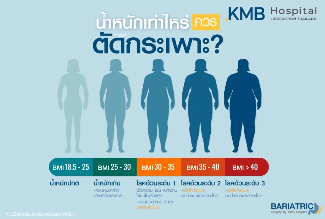 น้ำหนักเท่าไหร่ควรตัดกระเพาะ
