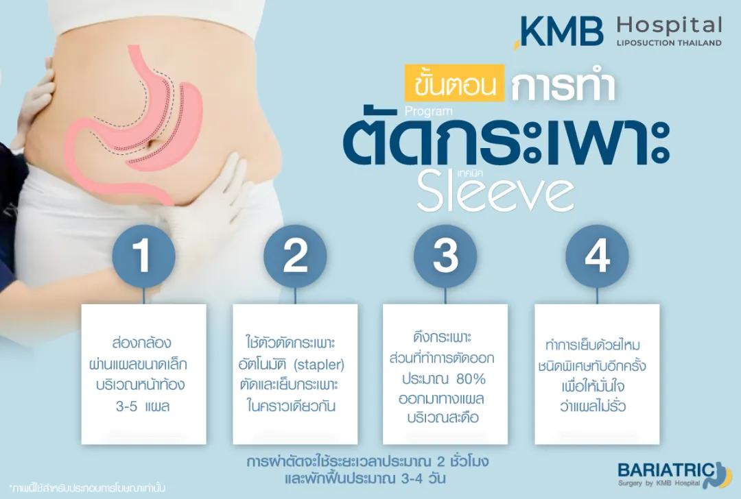 ขั้นตอนการตัดกระเพาะ