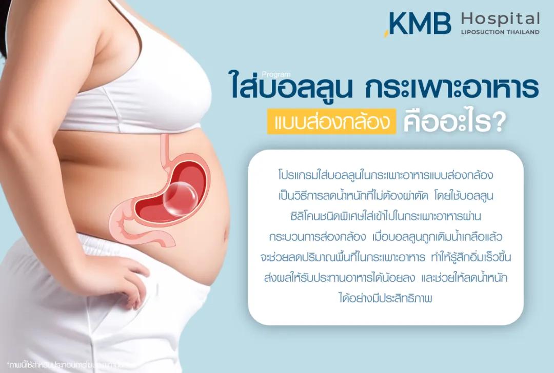 ใส่บอลลูนกระเพาะอาหาร คืออะไร