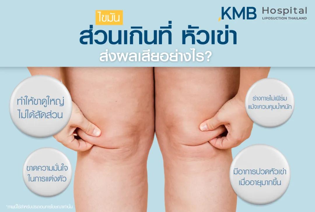 ส่วนเกินที่หัวเข่า ส่งผลเสียอย่างไร