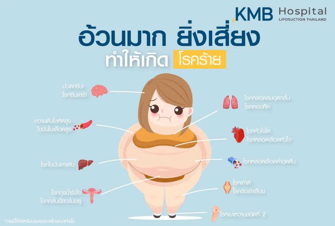 อ้วนมากยิ่งเสี่ยง