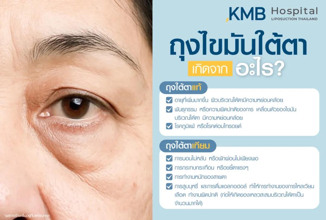 ถุงไขมันใต้ตาเกิดจากอะไร