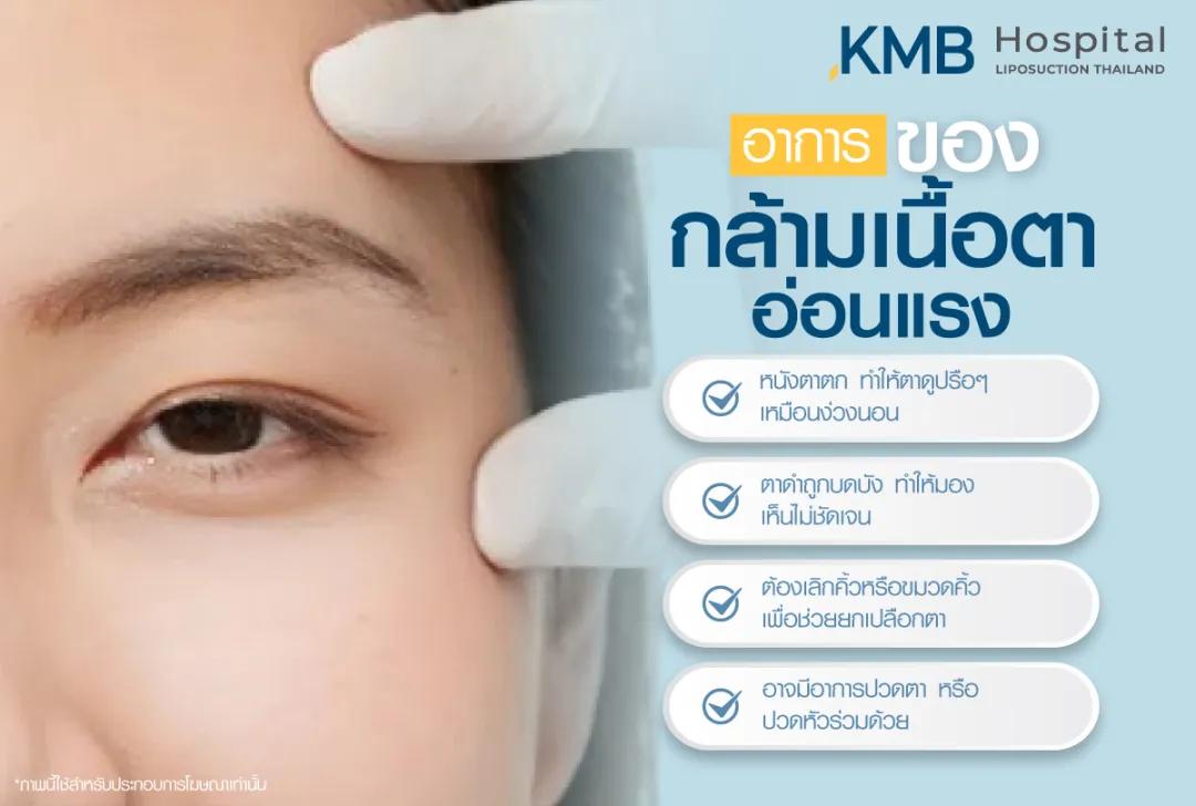 อาการของกล้ามเนื้อตาอ่อนแรง