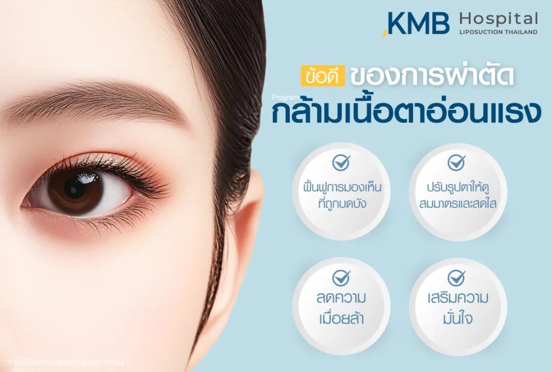 ข้อดีของการผ่าตัดกล้ามเนื้อตาอ่อนแรง