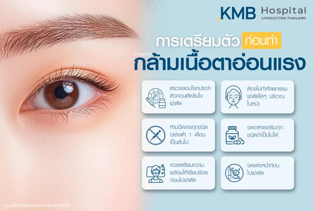 การเตรียมตัวก่อนผ่าตัดกล้ามเนื้อตาอ่อนแรง