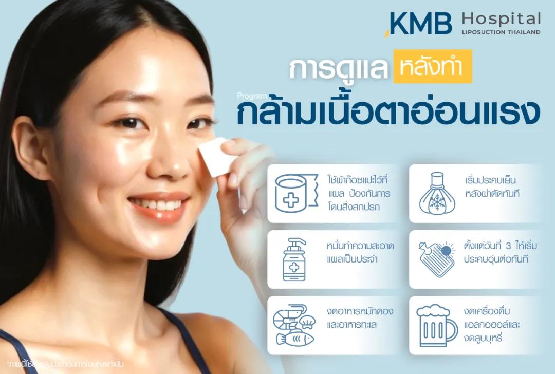 การดูแลหลังผ่าตัดกล้ามเนื้อหาอ่อนแรง