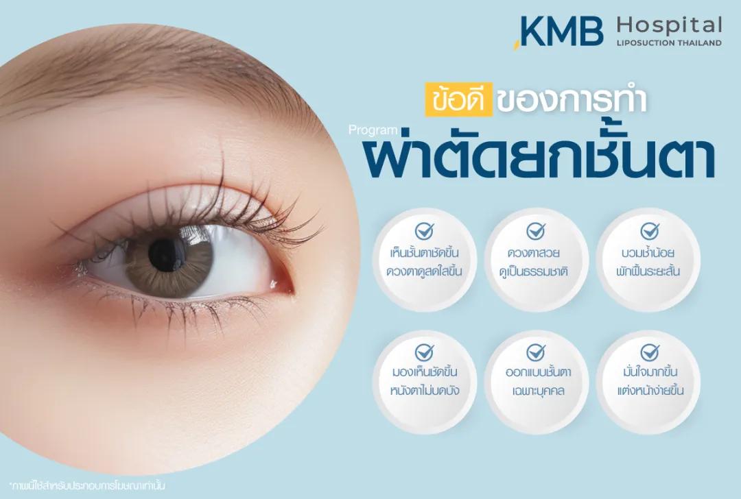 ข้อดีของการผ่าตัดยกชั้นตา